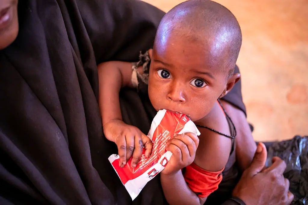 Bambino che mangia alimento terapeutico